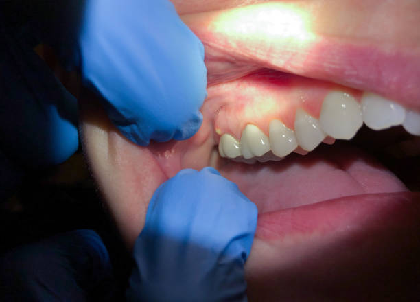 Best After-Hours Dental Trauma Care in Pascagoula, MS